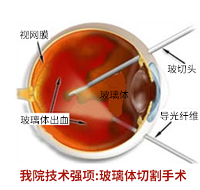儿童青少年近视防控文章推荐